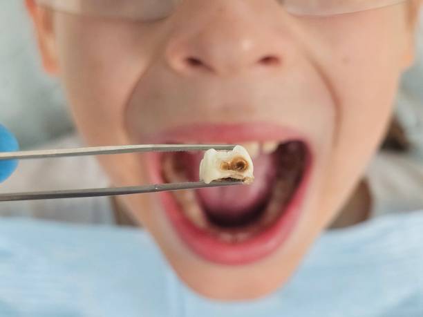 Best Emergency Pediatric Dental Care in Cottonwood, ID